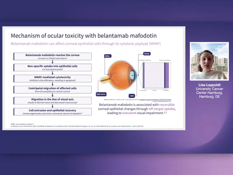 Strategies for managing belantamab mafodotin-associated ocular toxicities